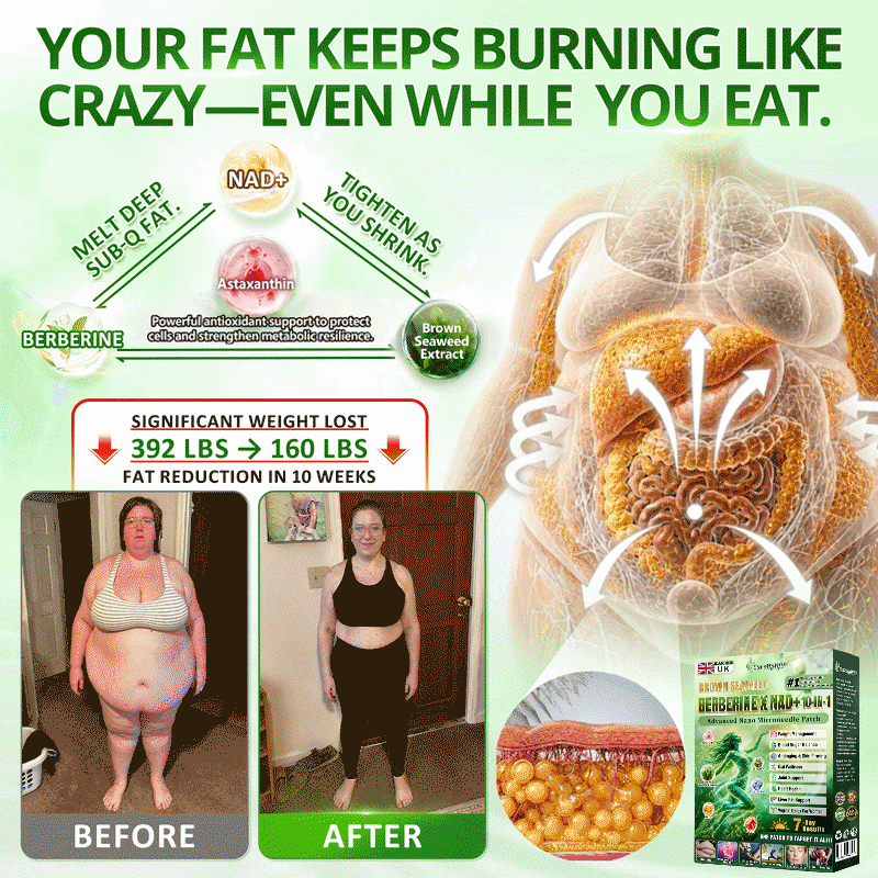 𝑶𝒇𝒇𝒊𝒄𝒊𝒂𝒍 𝑺𝒕𝒐𝒓𝒆 | 𝐍𝐞𝐰!🍀𝐂𝐚𝐫𝐞𝐔𝐩𝐥𝐢𝐟𝐭® 𝐁𝐫𝐨𝐰𝐧 𝐒𝐞𝐚𝐰𝐞𝐞𝐝× 𝐁𝐞𝐫𝐛𝐞𝐫𝐢𝐧𝐞× 𝐍𝐃𝐀+ 𝟏𝟎-𝐢𝐧-𝟏 𝐍𝐚𝐧𝐨 𝐌𝐢𝐜𝐫𝐨𝐧𝐞𝐞𝐝𝐥𝐞 𝐏𝐚𝐭𝐜𝐡(𝐉𝐮𝐬𝐭 𝐨𝐧𝐜𝐞 𝐚 𝐝𝐚𝐲, 𝐯𝐢𝐬𝐢𝐛𝐥𝐞 𝐜𝐡𝐚𝐧𝐠𝐞𝐬 𝐢𝐧 𝟕 𝐝𝐚𝐲𝐬）𝘽𝙚𝙧𝙗𝙚𝙧𝙞𝙣𝙚 + 𝐁𝐫𝐨𝐰𝐧 𝐒𝐞𝐚𝐰𝐞𝐞𝐝 𝙁𝙤𝙧𝙢𝙪𝙡𝙖 ✅ 𝐅𝐨𝐫 𝐨𝐛𝐞𝐬𝐢𝐭𝐲, 𝗟𝗼𝗼𝘀𝗲 𝘀𝗸𝗶𝗻,𝐝𝐢𝐚𝐛𝐞𝐭𝐞𝐬, 𝐬𝐥𝐞𝐞𝐩 𝐚𝐩𝐧𝐞𝐚, 𝐣𝐨𝐢𝐧𝐭 𝐢𝐬𝐬𝐮𝐞𝐬, 𝐚𝐧𝐝 𝐦𝐨𝐫𝐞💯💯
