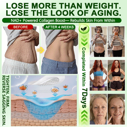 𝑶𝒇𝒇𝒊𝒄𝒊𝒂𝒍 𝑺𝒕𝒐𝒓𝒆 | 𝐍𝐞𝐰!🍀𝐂𝐚𝐫𝐞𝐔𝐩𝐥𝐢𝐟𝐭® 𝐁𝐫𝐨𝐰𝐧 𝐒𝐞𝐚𝐰𝐞𝐞𝐝× 𝐁𝐞𝐫𝐛𝐞𝐫𝐢𝐧𝐞× 𝐍𝐃𝐀+ 𝟏𝟎-𝐢𝐧-𝟏 𝐍𝐚𝐧𝐨 𝐌𝐢𝐜𝐫𝐨𝐧𝐞𝐞𝐝𝐥𝐞 𝐏𝐚𝐭𝐜𝐡(𝐉𝐮𝐬𝐭 𝐨𝐧𝐜𝐞 𝐚 𝐝𝐚𝐲, 𝐯𝐢𝐬𝐢𝐛𝐥𝐞 𝐜𝐡𝐚𝐧𝐠𝐞𝐬 𝐢𝐧 𝟕 𝐝𝐚𝐲𝐬）𝘽𝙚𝙧𝙗𝙚𝙧𝙞𝙣𝙚 + 𝐁𝐫𝐨𝐰𝐧 𝐒𝐞𝐚𝐰𝐞𝐞𝐝 𝙁𝙤𝙧𝙢𝙪𝙡𝙖 ✅ 𝐅𝐨𝐫 𝐨𝐛𝐞𝐬𝐢𝐭𝐲, 𝗟𝗼𝗼𝘀𝗲 𝘀𝗸𝗶𝗻,𝐝𝐢𝐚𝐛𝐞𝐭𝐞𝐬, 𝐬𝐥𝐞𝐞𝐩 𝐚𝐩𝐧𝐞𝐚, 𝐣𝐨𝐢𝐧𝐭 𝐢𝐬𝐬𝐮𝐞𝐬, 𝐚𝐧𝐝 𝐦𝐨𝐫𝐞💯💯